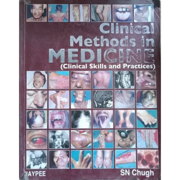 Clinical Methods In Medicine by SN Chugh