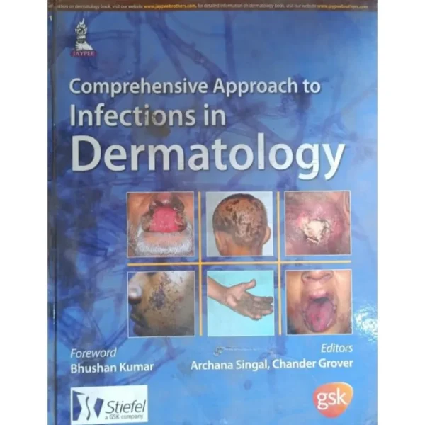 Comprehensive Approach To Infections In Dermatology by Archana Singal