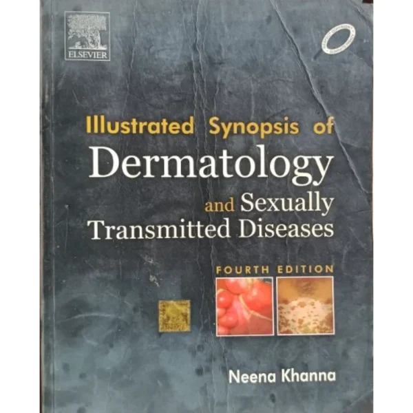 Illustrated Synopsis Of Dermatology & Sexually Transmitted Diseases 4th Edition by Neena Khanna