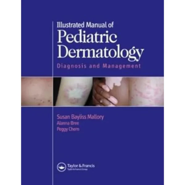 Illustrated Manual Of Pediatric Dermatology by Susan Bayliss Mallory