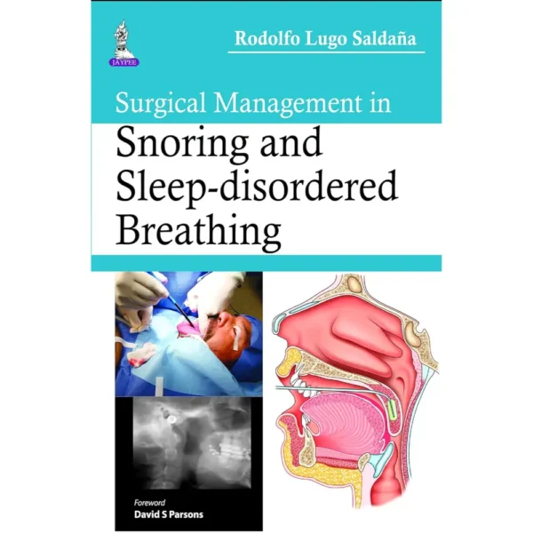 Surgical Management In Snoring And Sleep-Disordered Breathing