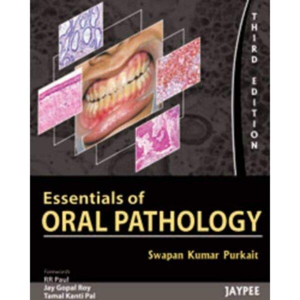 Essentials Of Oral Pathology 3rd Edition by Swapan Kumar Purkait