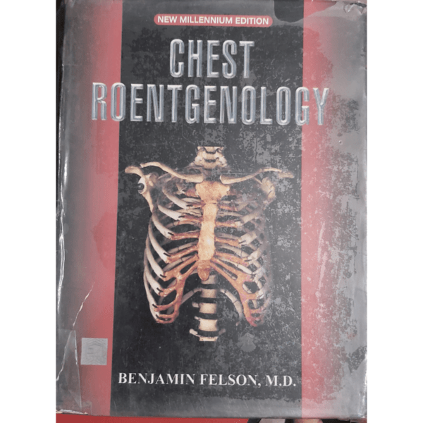 Chest Roentgenology New Millennium Edition by Benjamin Felson